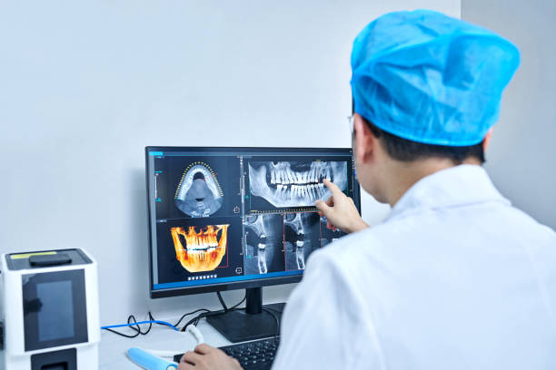 Best Broken or Chipped Tooth Repair in Fountainebleau, FL